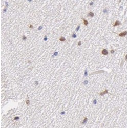 NK1 Homeobox 2 (NKX1-2) Antibody