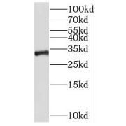 WB analysis of SH-SY5Y cells, using NKX1-2 antibody (1/300 dilution).