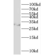 WB analysis of Min6 cells, using NKX2-2 antibody dilution).