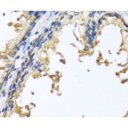 Neuroligin 4, Y-Linked (NLGN4Y) Antibody