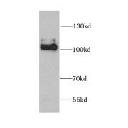 WB analysis of mouse brain tissue, using NLGN4Y antibody (1/1000 dilution).