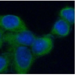 Glutamate Receptor Ionotropic, NMDA 2A (GRIN2A) Antibody