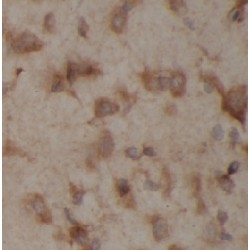 Glutamate Receptor Ionotropic, NMDA 2A (GRIN2A) Antibody