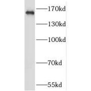 WB analysis of mouse brain tissue, using NMDAR2A antibody (1/500 dilution).