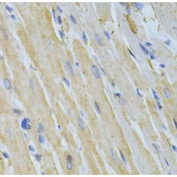 Nucleoside Diphosphate Kinase A (NME1) Antibody