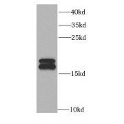 WB analysis of HeLa cells, using NME1 antibody (1/1500 dilution).
