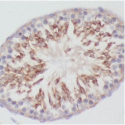 NME/NM23 Family Member 5 (NME5) Antibody