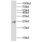 WB analysis of mouse testis tissue, using NME5 antibody (1/500 dilution).