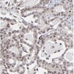 Nicotinamide Nucleotide Adenylyltransferase 1 (NMNAT1) Antibody