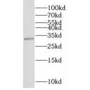 WB analysis of human testis tissue, using NMNAT1 antibody (1/500 dilution).