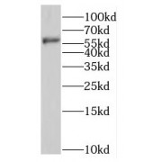 WB analysis of SKOV-3 cells, using NMT1 antibody (1/1000 dilution).