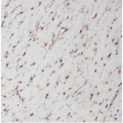 Neuromedin U Receptor 1 (NMUR1) Antibody