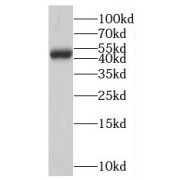 WB analysis of human colon tissue, using NMUR1 antibody (1/300 dilution).