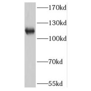 WB analysis of human adrenal gland tissue, using NNT antibody (1/300 dilution).