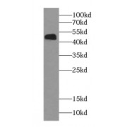 WB analysis of Jurkat cells, using NOB1 antibody (1/3000 dilution).