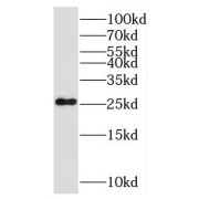 WB analysis of HeLa cells, using NOG antibody (1/1500 dilution).