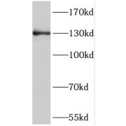 WB analysis of SGC-7901 cells, using NOL6 antibody (1/600 dilution).