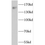 WB analysis of SGC-7901 cells, using NOL8 antibody (1/500 dilution).