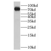 WB analysis of HEK-293 cells, using NOL9 antibody (1/1000 dilution).