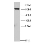 WB analysis of MCF7 cells, using NONO antibody (1/1000 dilution).