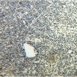 NOP2 Nucleolar Protein (NOP2) Antibody