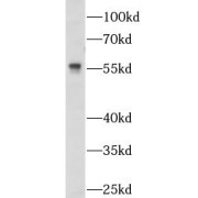 WB analysis of mouse heart tissue, using NOSTRIN antibody (1/600 dilution).