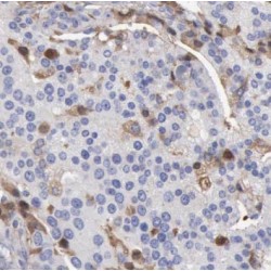 Nephroblastoma Overexpressed Gene (NOV) Antibody