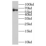 WB analysis of mouse brain tissue, using NOVA2 antibody (1/500 dilution).