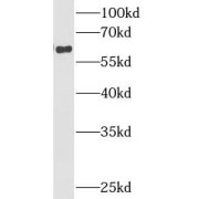 WB analysis of mouse spleen tissue, using NOX2 antibody (1/1000 dilution).