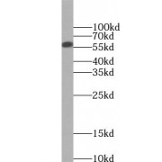 WB analysis of HeLa cells, using NOX4 antibody (1/600 dilution).