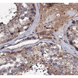 NADPH Oxidase 5 (NOX5) Antibody