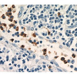 Neutrophil Cytosol Factor 2 (NCF2) Antibody