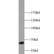 WB analysis of COLO 320 cells, using NCF2 antibody (1/1000 dilution).