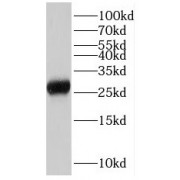 WB analysis of human brain tissue, using NPAS3 antibody (1/600 dilution).