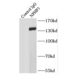 Nephrocystin 3 (NPHP3) Antibody