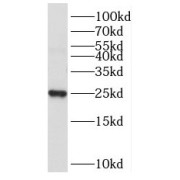 WB analysis of HeLa cells, using NPM3 antibody (1/500 dilution).