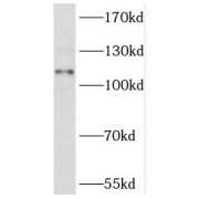 WB analysis of HEK293 cells, using NPR2 antibody (1/1000 dilution).