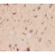 IHC-P analysis of human brain tissue, using Neuropeptide Y antibody (1/200 dilution).