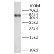 WB analysis of human placenta tissue, using NR2F1 antibody (1/600 dilution).