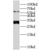 WB analysis of mouse kidney tissue, using NRBP2 antibody (1/500 dilution).