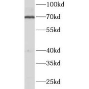 WB analysis of A549 cells, using NRF1 antibody (1/1000 dilution).