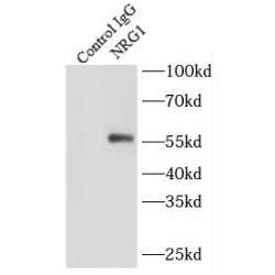 Neuregulin 1 (NRG1) Antibody