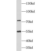 WB analysis of human liver tissue, using NRG1 antibody (1/250 dilution).