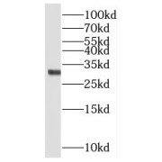 WB analysis of human heart tissue, using NRIP2 antibody (1/800 dilution).