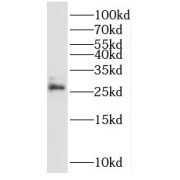 WB analysis of MCF-7 cells, using NRIP3 antibody (1/300 dilution).