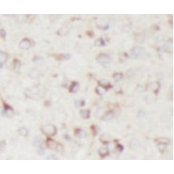 Neuron-Specific Enolase (NSE) Antibody