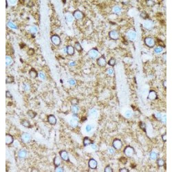 Neuron-Specific Enolase (NSE) Antibody