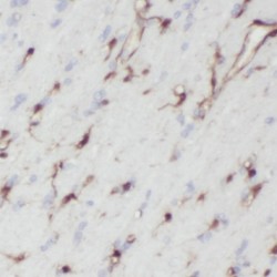 Neuron-Specific Enolase (NSE) Antibody