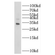 WB analysis of Y79 cells, using NTHL1 antibody (1/1000 dilution).