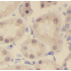 NUAK Family Kinase 2 (NUAK2) Antibody